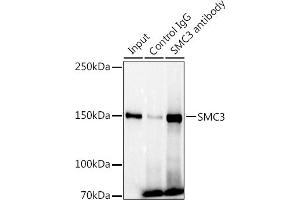 Immunoprecipitation analysis of 300 μg extracts of U-87MG cells using 3 μg SMC3 antibody (ABIN7270616). (SMC3 anticorps)
