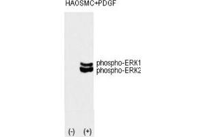 Western Blotting (WB) image for anti-Mitogen-Activated Protein Kinase 1/3 (MAPK1/3) (pThr202), (pTyr204) antibody (ABIN3001885)