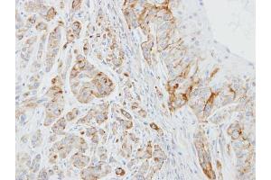 IHC-P Image Immunohistochemical analysis of paraffin-embedded A549 xenograft, using EPB41L3, antibody at 1:100 dilution. (EPB41L3 anticorps  (C-Term))