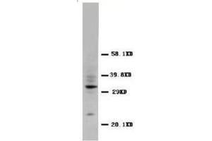 Western blot analysis of rat tissue sections (spleen) using CD40L antibody (CD40 Ligand anticorps  (N-Term))