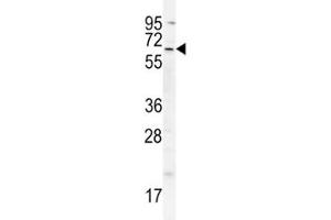 cIAP2 antibody western blot analysis in A549 lysate