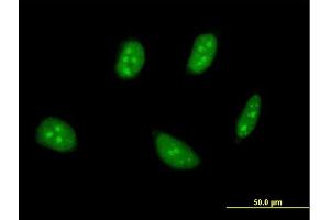 Immunofluorescence of monoclonal antibody to TSC22D4 on HeLa cell.