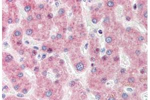 Human Liver (formalin-fixed, paraffin-embedded) stained with IRF3 antibody ABIN337252 at 1:50 followed by biotinylated goat anti-rabbit IgG secondary antibody ABIN481713, alkaline phosphatase-streptavidin and chromogen. (IRF3 anticorps)