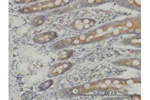 Image no. 1 for anti-Mitogen-Activated Protein Kinase Kinase Kinase 4 (MAP3K4) (AA 1201-1300) antibody (ABIN598812) (MAP3K4 anticorps  (AA 1201-1300))