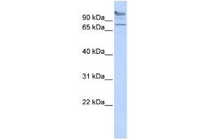 WB Suggested Anti-ZNF509 Antibody Titration:  0. (ZBTB49 anticorps  (Middle Region))