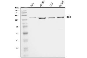 Western blot analysis of PDE4DIP using anti-PDE4DIP antibody (ABIN7602691).