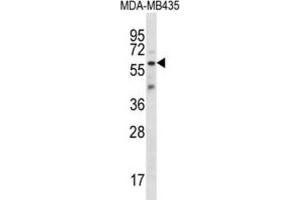 Western Blotting (WB) image for anti-Fascin 3 (FSCN3) antibody (ABIN2997133) (Fascin 3 anticorps)