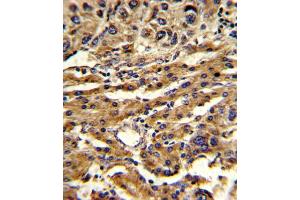 Immunohistochemistry (IHC) image for anti-ATP-Binding Cassette, Sub-Family G (WHITE), Member 1 (ABCG1) antibody (ABIN3002669) (ABCG1 anticorps)