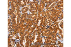 Immunohistochemistry of Human brain  using TNFRSF8 Polyclonal Antibody at dilution of 1:60 (TNFRSF8 anticorps)