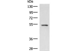 Western blot analysis of Rat liver tissue lysate using ONECUT1 Polyclonal Antibody at dilution of 1:600 (ONECUT1 anticorps)