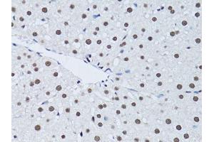 Immunohistochemistry of paraffin-embedded rat liver using PCNA antibody. (PCNA anticorps  (AA 1-261))