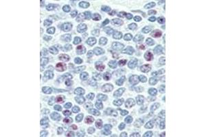 Image no. 2 for anti-Nanog Homeobox (NANOG) (AA 25-54), (N-Term) antibody (ABIN357014) (Nanog anticorps  (N-Term))