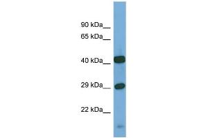 Host:  Rabbit  Target Name:  SGSH  Sample Type:  PANC1 Whole Cell lysates  Antibody Dilution:  1. (SGSH anticorps  (C-Term))