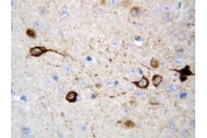 Anti-CAMKK2 antibody, IHC(P) IHC(P): Rat Brain Tissue (CAMKK2 anticorps  (Middle Region))