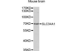 Western blot analysis of extracts of mouse brain, using SLC34A1 antibody. (Solute Carrier Family 34 (Type II Sodium/phosphate Contransporter), Member 1 (SLC34A1) anticorps)