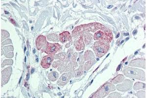 Heart, Human: Formalin-Fixed, Paraffin-Embedded (FFPE)