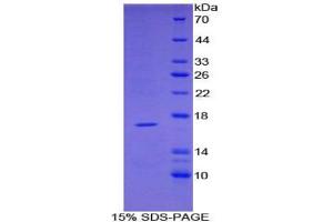 SDS-PAGE analysis of Mouse TNFRSF19L Protein. (TNFRSF19 Protéine)