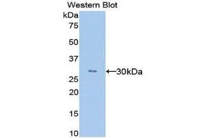 Western Blotting (WB) image for anti-Angiopoietin-Like 4 (ANGPTL4) (AA 182-394) antibody (ABIN1858006) (ANGPTL4 anticorps  (AA 182-394))