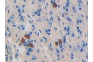 Detection of DNM1 in Mouse Stomach Tissue using Polyclonal Antibody to Dynamin 1 (DNM1)