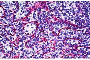 Human Spleen: Formalin-Fixed, Paraffin-Embedded (FFPE) (TIE1 anticorps  (Internal Region))