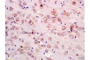 Formalin-fixed and paraffin embedded rat brain labeled with Anti-NEDD4 Polyclonal Antibody, Unconjugated (ABIN872620) at 1:200 followed by conjugation to the secondary antibody and DAB staining