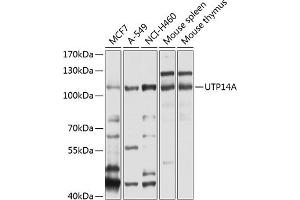 Western blot analysis of extracts of various cell lines, using UTP14A antibody  at 1:1000 dilution. (UTP14A anticorps  (AA 1-260))