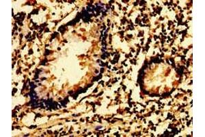 Immunohistochemistry of paraffin-embedded human appendix tissue using ABIN7174068 at dilution of 1:100 (SYK anticorps  (AA 260-361))