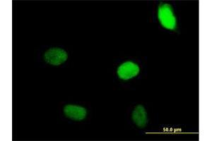 Immunofluorescence of purified MaxPab antibody to ZNF35 on HeLa cell. (ZNF35 anticorps  (AA 1-519))
