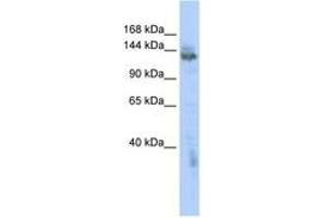 Image no. 1 for anti-Zinc Finger, MYND-Type Containing 8 (ZMYND8) (AA 1115-1164) antibody (ABIN6742534) (ZMYND8 anticorps  (AA 1115-1164))