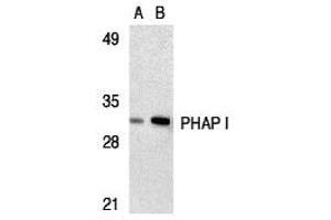 Western Blotting (WB) image for anti-PHAP I (C-Term) antibody (ABIN1030578) (PHAP I anticorps  (C-Term))