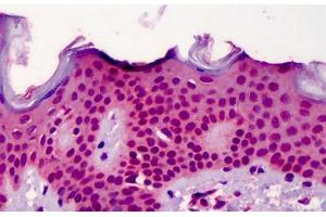 Human Skin: Formalin-Fixed, Paraffin-Embedded (FFPE)