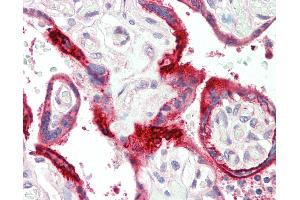 Anti-C11orf2 / Fat-Free antibody IHC staining of human placenta.