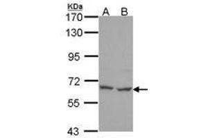 Image no. 1 for anti-Polynucleotide Kinase 3'-Phosphatase (PNKP) (AA 1-243) antibody (ABIN467497) (PNKP anticorps  (AA 1-243))