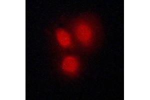 ABIN6269137 staining A549 cells by ICC/IF.