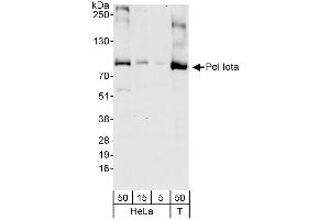 Western Blotting (WB) image for anti-Polymerase (DNA Directed), mu (POLM) (AA 690-715) antibody (ABIN7451969)