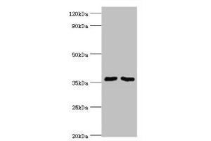 Western blot All lanes: Methylosome protein 50 antibody at 6 μg/mL Lane 1: Hela whole cell lysate Lane 2: HepG2 whole cell lysate Secondary Goat polyclonal to rabbit IgG at 1/10000 dilution Predicted band size: 37, 30 kDa Observed band size: 37 kDa (WDR77 anticorps  (AA 1-260))