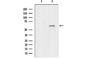 anti-Rabaptin, RAB GTPase Binding Effector Protein 2 (RABEP2) (Internal Region) antibody