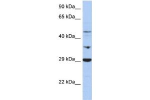 WB Suggested Anti-PDK3 Antibody Titration:  0. (PDK3 anticorps  (Middle Region))