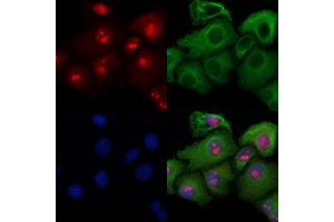 ABIN6258822 and ABIN6274418 staining Hela cells by IF/ICC. (MAP4K3 anticorps  (N-Term))