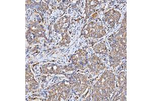 IHC analysis of SRPRB using anti-SRPRB antibody (ABIN7602015).
