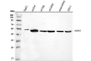 Western blot analysis of ALDH2 using anti-ALDH2 antibody (ABIN3043782). (ALDH2 anticorps  (N-Term))