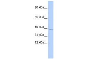 Image no. 1 for anti-Ts Translation Elongation Factor, Mitochondrial (TSFM) (AA 144-193) antibody (ABIN6740259) (TSFM anticorps  (AA 144-193))