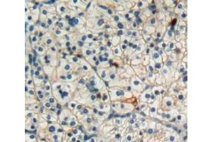 Used in DAB staining on fromalin fixed paraffin-embedded kidney cancer tissue (FAS anticorps  (AA 21-170))