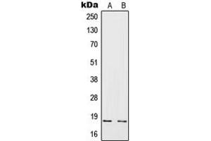 Western blot analysis of IL-4 expression in HeLa (A), Raji (B) whole cell lysates. (IL-4 anticorps  (Center))
