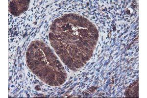 Image no. 1 for anti-Kelch-Like ECH-Associated Protein 1 (KEAP1) antibody (ABIN1499016)