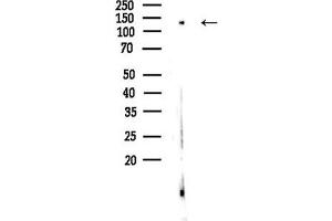 Western blot analysis of lysates from EC304 cells, using PLC Antibody at 1/1000 dilution.