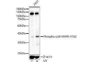 Western blot analysis of extracts of various cell lines, using Phospho-p38 MAPK-Y182 antibody (ABIN3023585, ABIN3023586, ABIN3023587 and ABIN6225421) at 1:500 dilution. (MAPK14 anticorps  (pTyr182))