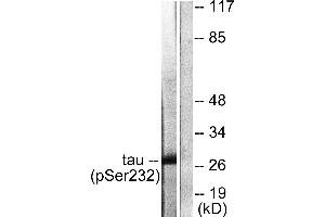 Immunohistochemistry analysis of paraffin-embedded human pancreas tissue using 14-3-3 θ/τ (Phospho-Ser232) antibody. (14-3-3 theta anticorps  (pSer232))