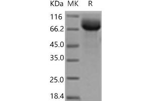 Western Blotting (WB) image for HEPACAM Family Member 2 (HEPACAM2) protein (Fc Tag) (ABIN7321175)