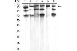 Western Blotting (WB) image for anti-phospholipase C, gamma 1 (PLCG1) (AA 1192-1291) antibody (ABIN5933333)